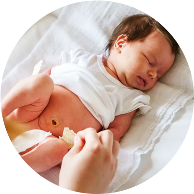 ¿Cómo cuidar el cordón umbilical de tu bebé?